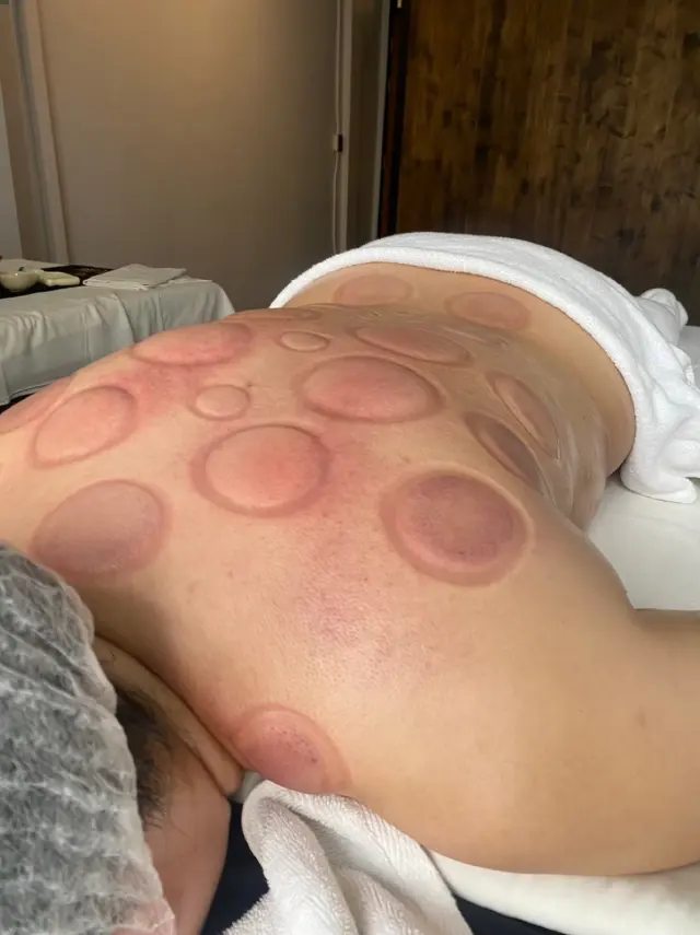 Complete back cup layout