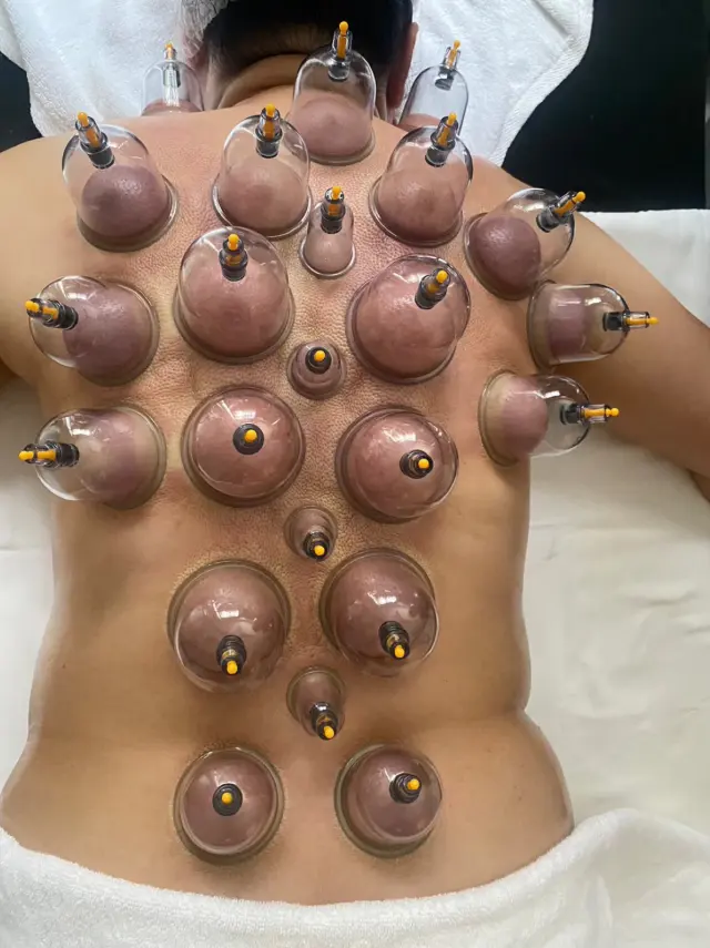 Shoulder palpation before cupping