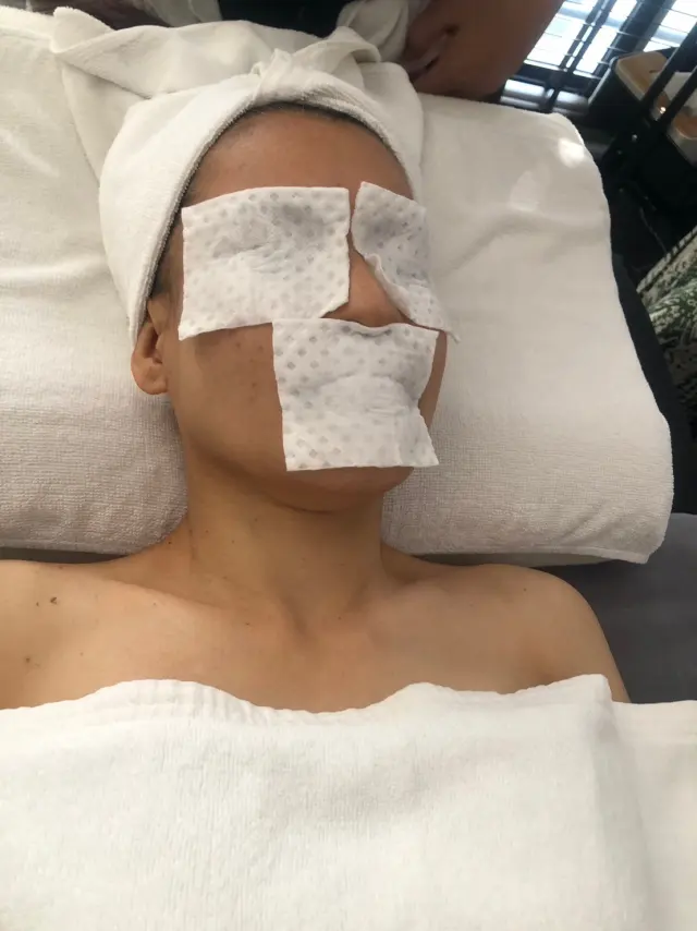 Cotton pad placement
