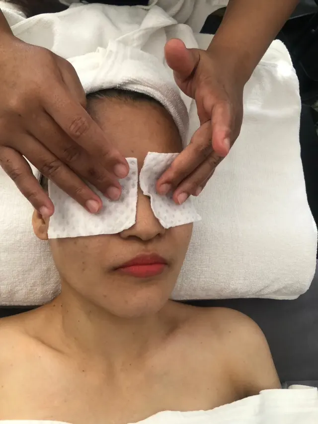 Eye-area preparation