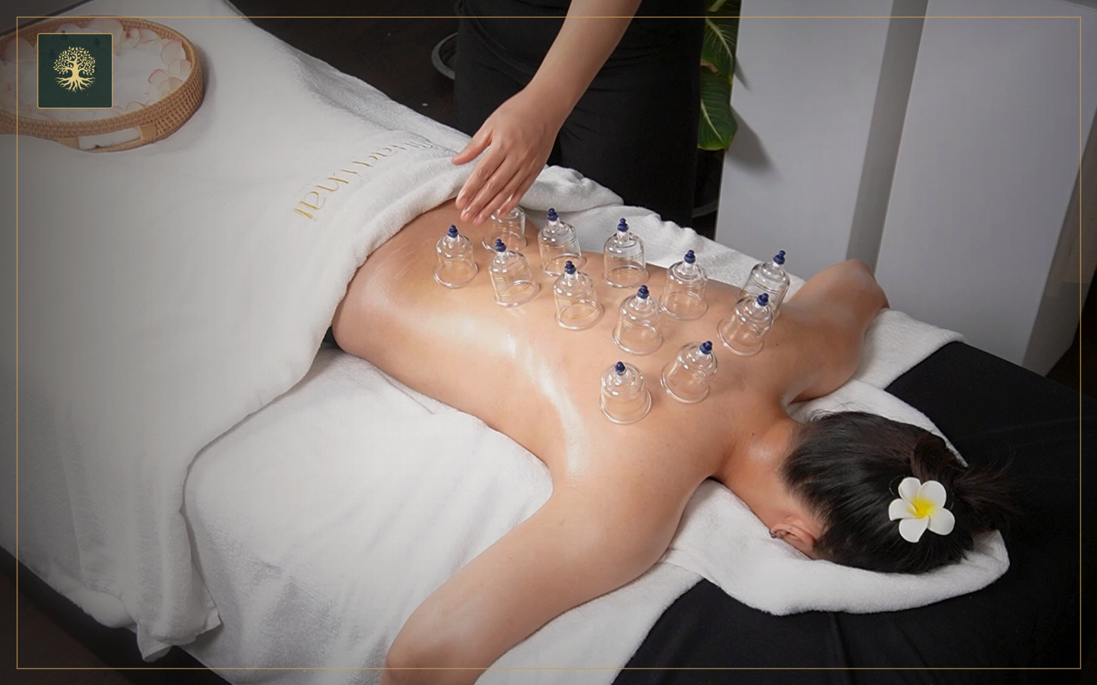 Cupping Therapy Course video course